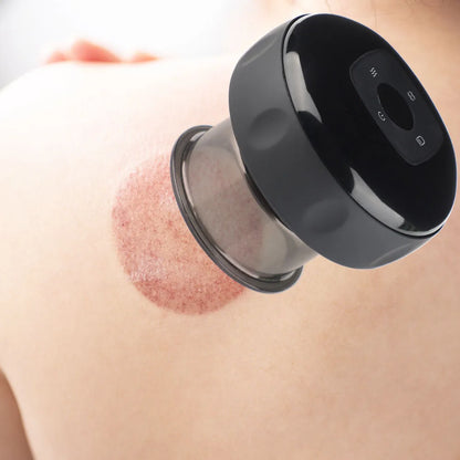 Wellthica™ Smart Cupping Massager